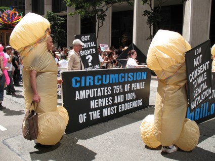 circumcision-amputates